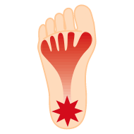 イラスト:インソールプロ メンズ 足底筋膜炎対策