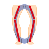 イラスト:インソールプロ メンズ O脚対策