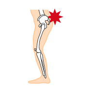 イラスト:インソールプロ メンズ 腰痛対策
