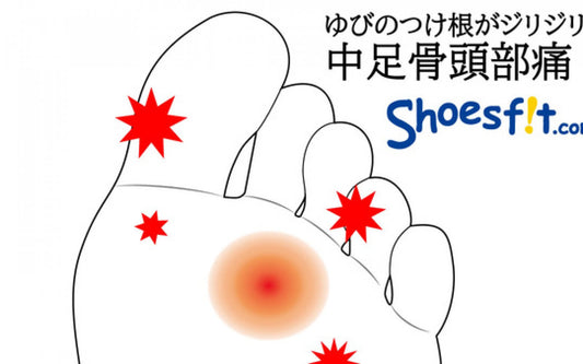 【足の症状シリーズ】ゆびのつけ根がジリジリ！中足骨頭部痛とインソールの話