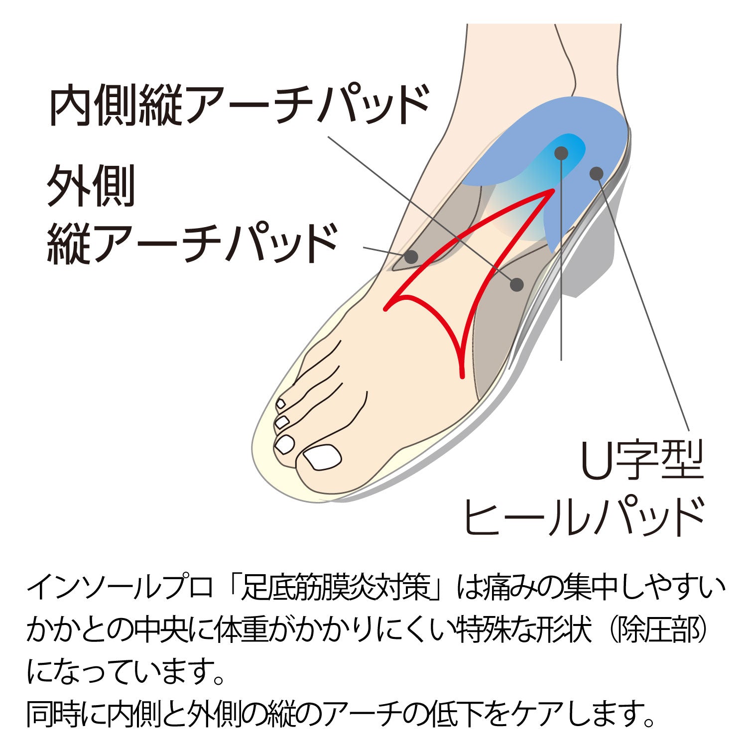 インソールプロ 足底筋膜炎対策 レディース 女性用 S M L 足底筋膜炎 インソール 足底腱膜炎 靴の中敷き 土踏まず 足底筋膜炎対策インソール