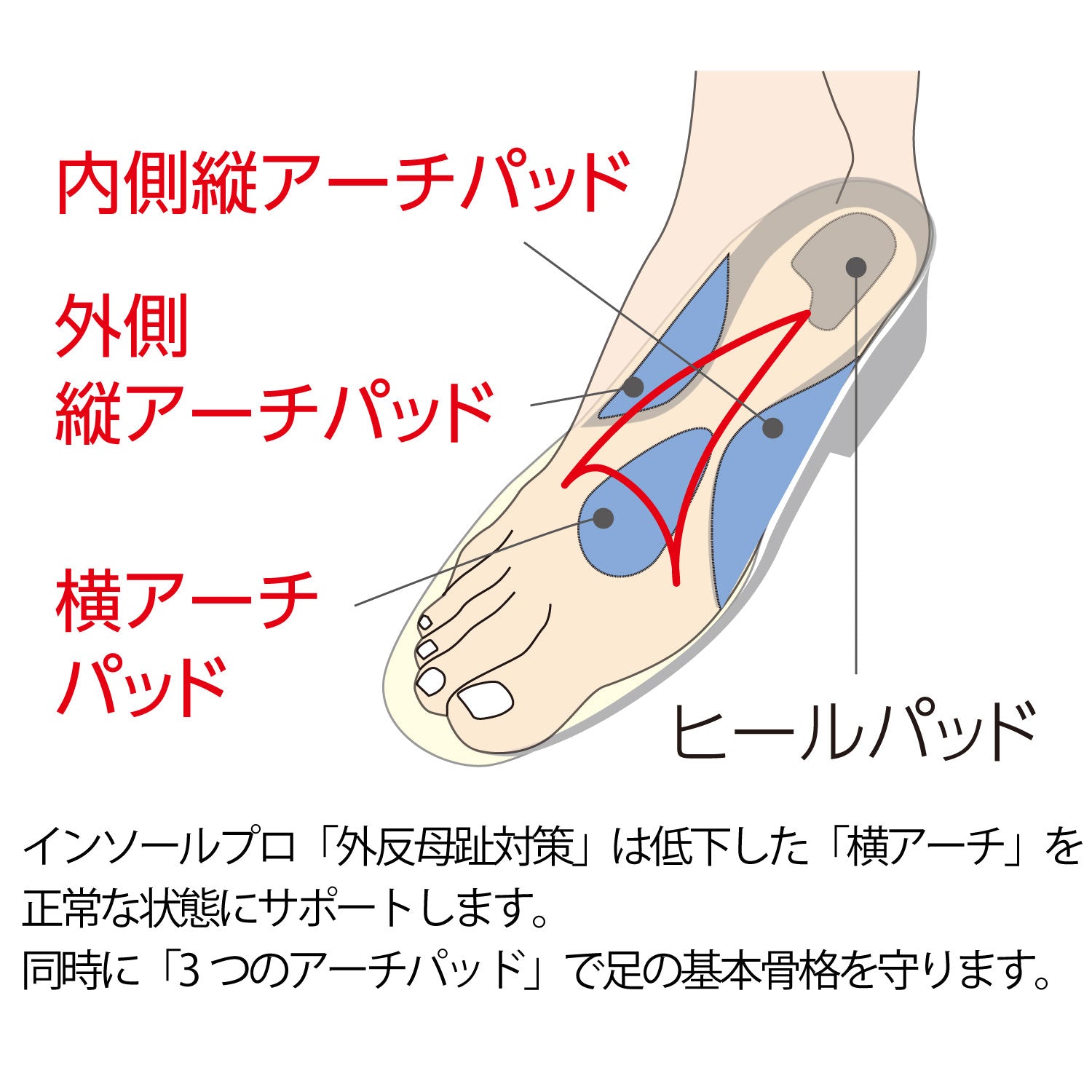インソールプロ外反母趾対策は低下した横アーチを正常な状態にサポートします