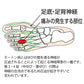 モートン病とはゆびの間を通る神経が圧迫されることによって起こる神経障害の一種です