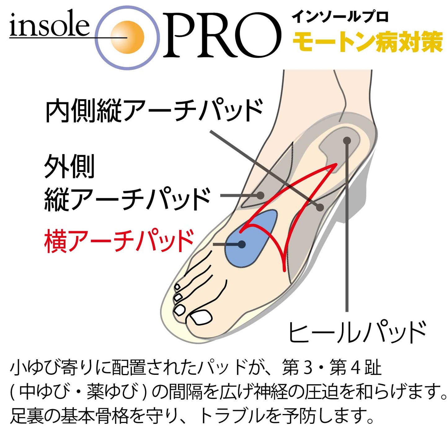 インソールプロモートン病対策はパッドが中ゆび・薬ゆびの間隔を広げ神経の圧迫を緩和します