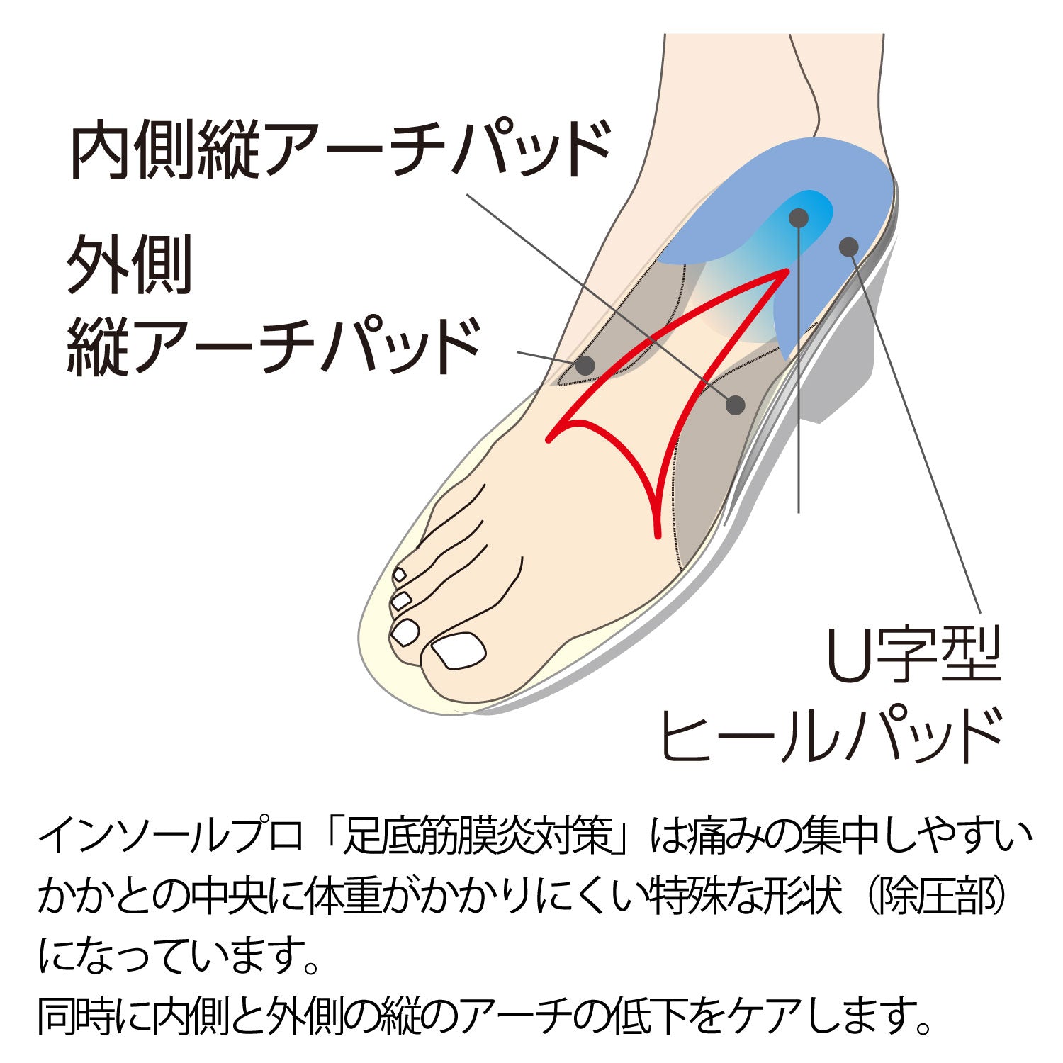 インソールプロ足底筋膜炎対策は痛みの集中しやすいかかとに圧力のかかりにくい独自形状です