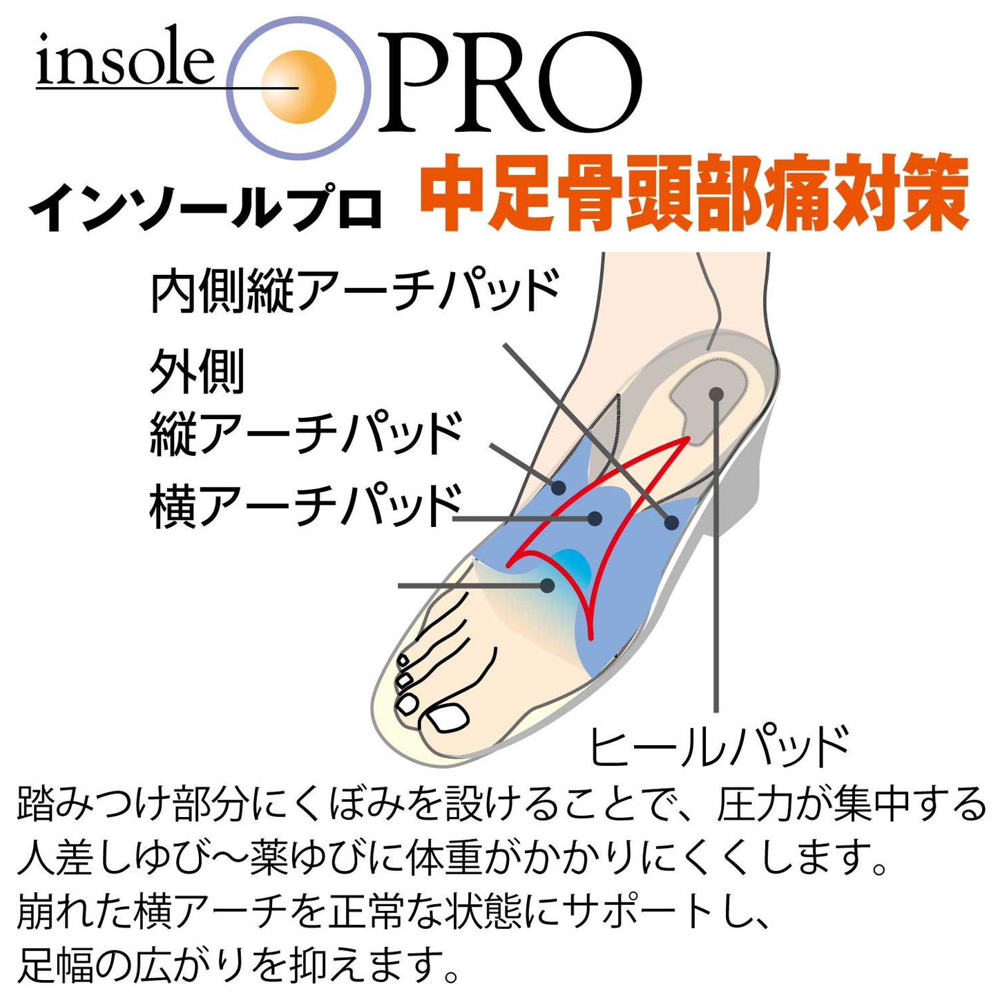 インソールプロ中足骨頭部痛対策は独自形状で患部への圧力を緩和しつつ横アーチをサポートします