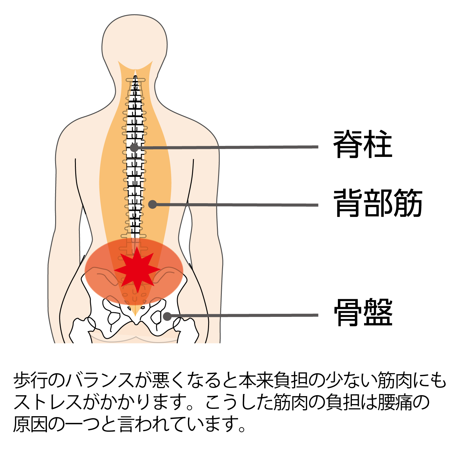 歩行のバランスが悪くなると本来負担の少ない筋肉にもストレスがかかります。こうした筋肉の負担は腰痛の原因の一つと言われています