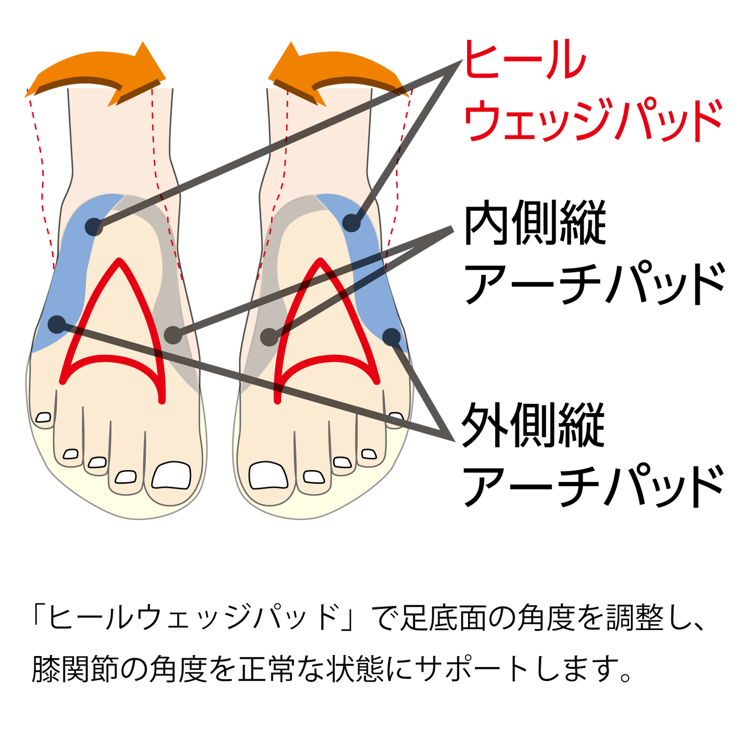 インソールプロO脚対策は「ヒールウェッジパッド」で足底面の角度を調整し、膝関節の角度を正常な状態にサポートします