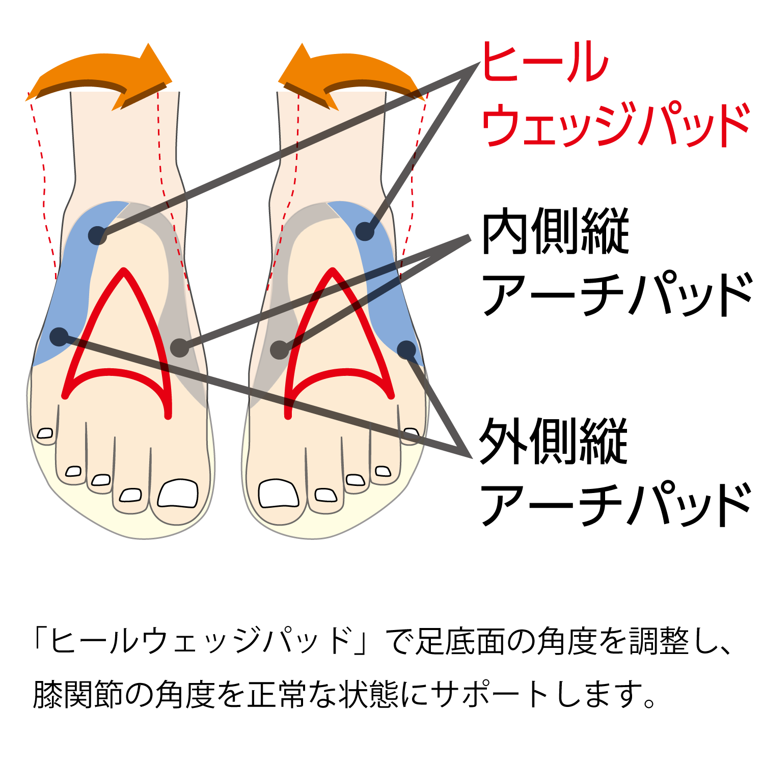インソールプロO脚対策は「ヒールウェッジパッド」で足底面の角度を調整し、膝関節の角度を正常な状態にサポートします